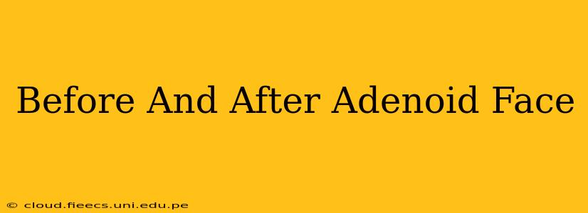Before And After Adenoid Face