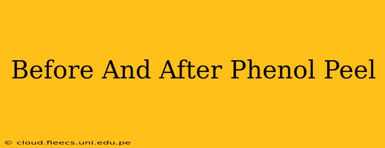 Before And After Phenol Peel