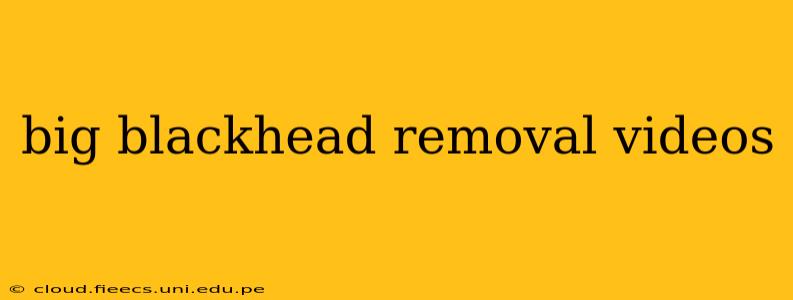 big blackhead removal videos