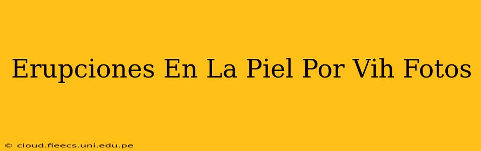 Erupciones En La Piel Por Vih Fotos