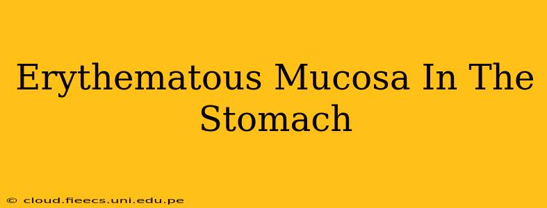 Erythematous Mucosa In The Stomach