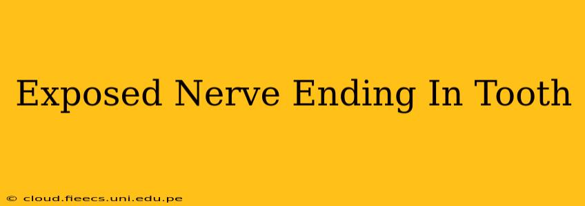 Exposed Nerve Ending In Tooth