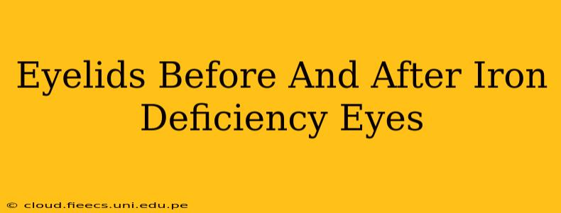 Eyelids Before And After Iron Deficiency Eyes