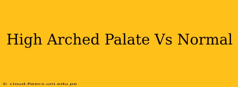 High Arched Palate Vs Normal