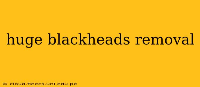 huge blackheads removal