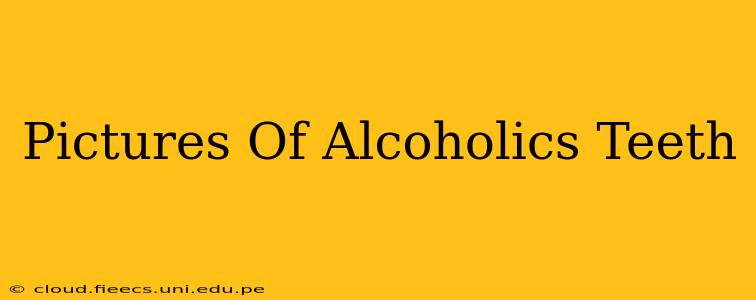 Pictures Of Alcoholics Teeth