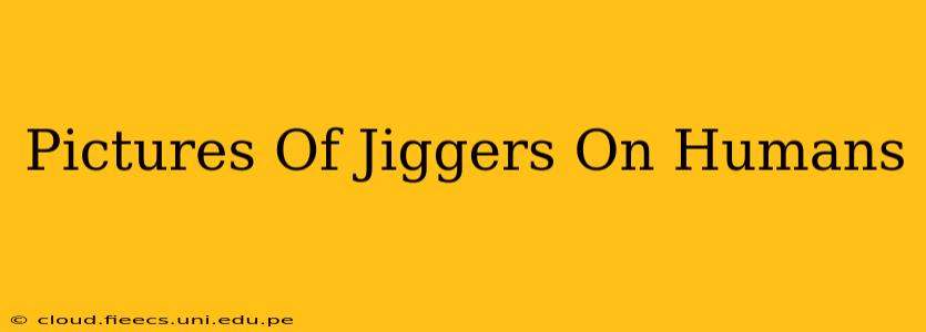 Pictures Of Jiggers On Humans