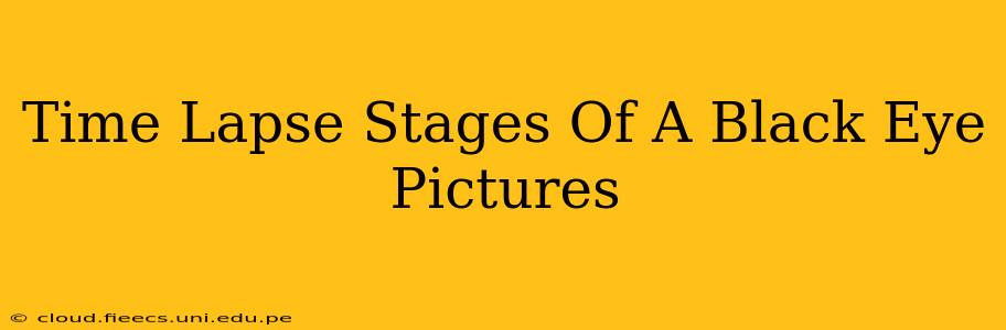 Time Lapse Stages Of A Black Eye Pictures