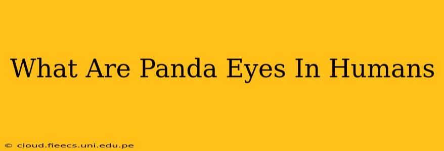 What Are Panda Eyes In Humans